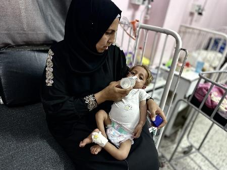 　ガザ南部ハンユニスの病院で、栄養失調と診断された３歳の子ども＝２２日（ゲッティ＝共同）