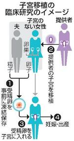 　子宮移植の臨床研究のイメージ