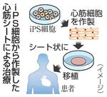 　ｉＰＳ細胞から作製した心筋シートによる治療（イメージ）